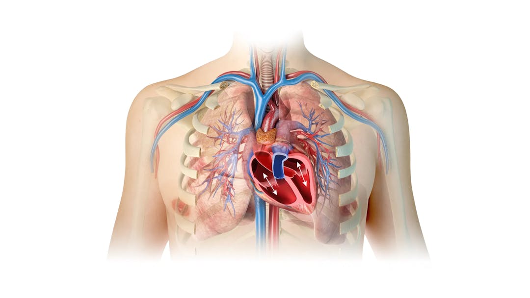 Pulmonary-Hypertrophy