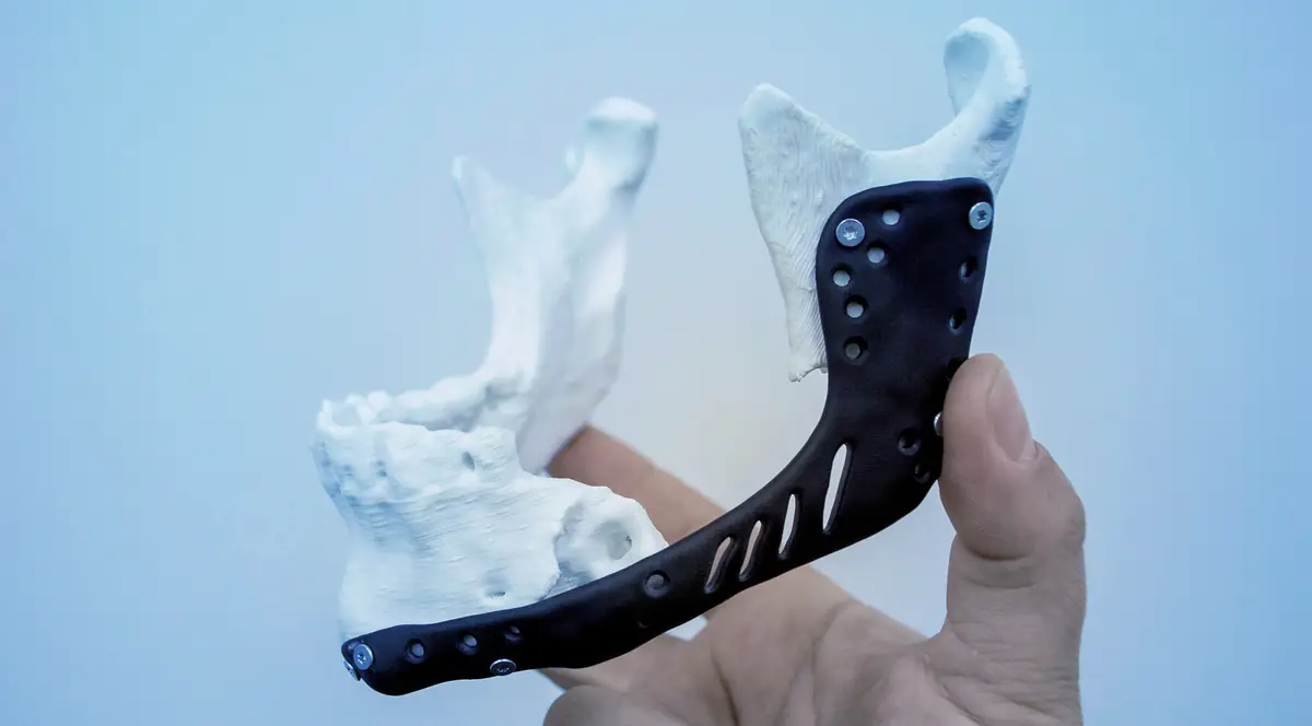 3D Radiological Graphics & 3D Printed CT Scans